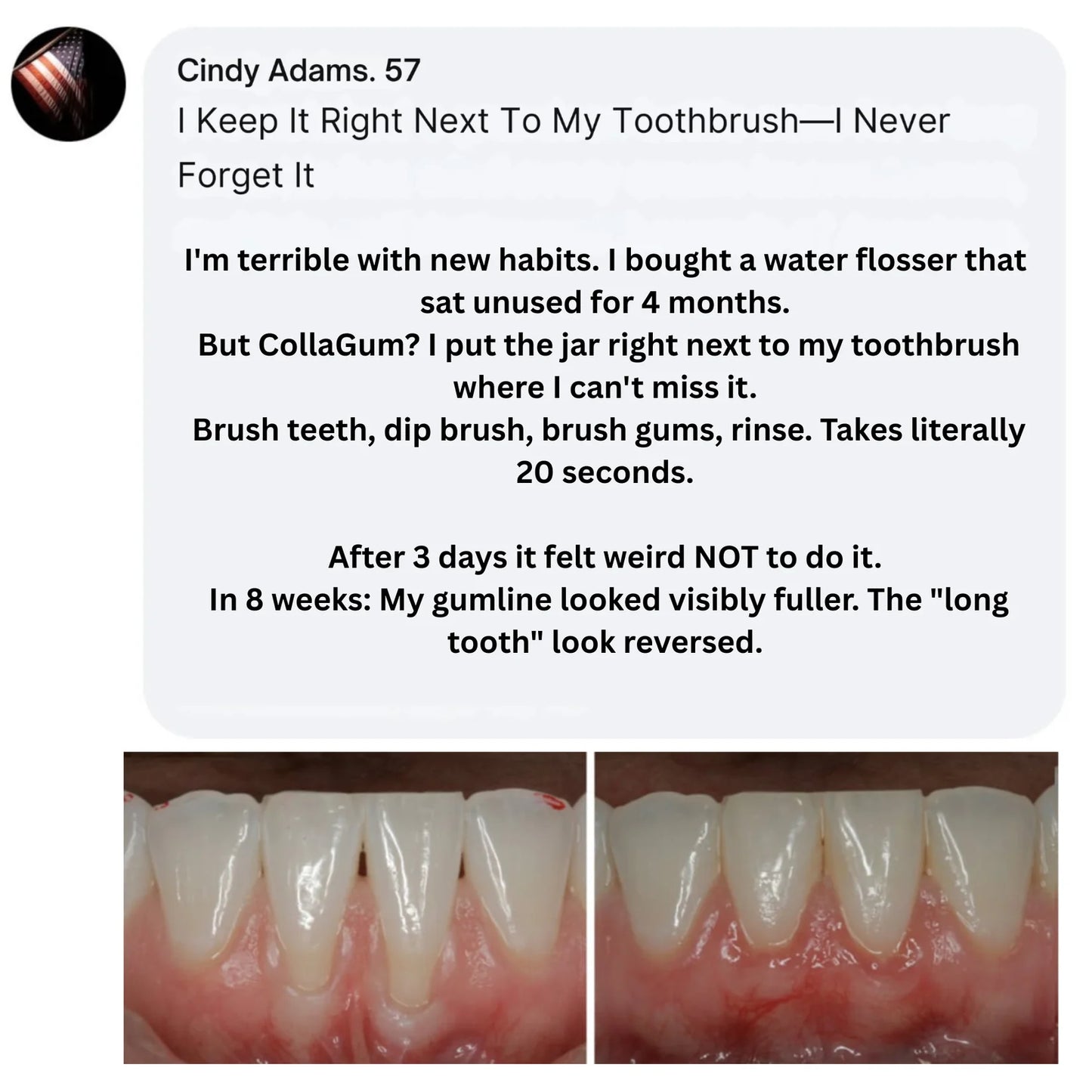 Colla Gum™